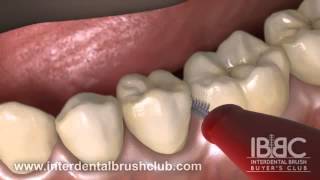 HOW TO USE AN INTERDENTAL BRUSH [upl. by Ellga]