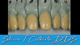 Why You Should Prep the Interproximal Wrap Veneers [upl. by Yelkao]