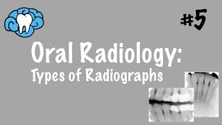 Oral Radiology  Types of Radiographs  INBDE ADAT [upl. by Blen]